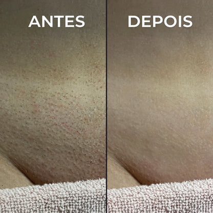 Inibidor vegetal de pelos