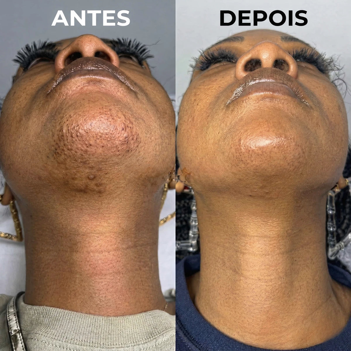 Inibidor vegetal de pelos