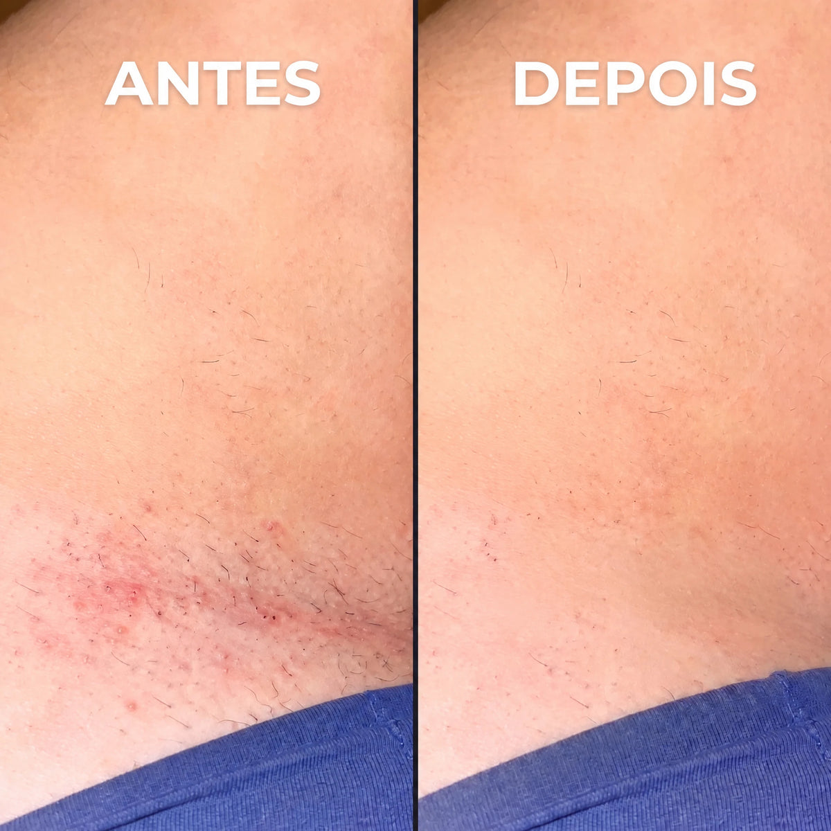 Inibidor vegetal de pelos