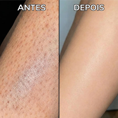 Inibidor vegetal de pelos