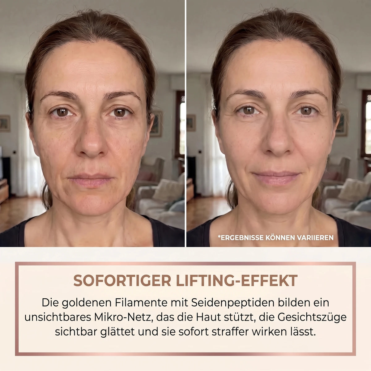Vorher-Nachher mit dem Marlia Lifting-Serum: sofortiger Lifting-Effekt