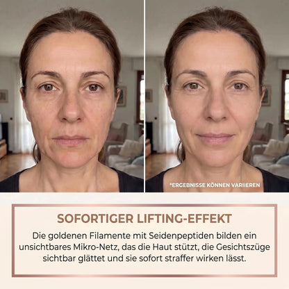 Vorher-Nachher mit dem Marlia Lifting-Serum: sofortiger Lifting-Effekt