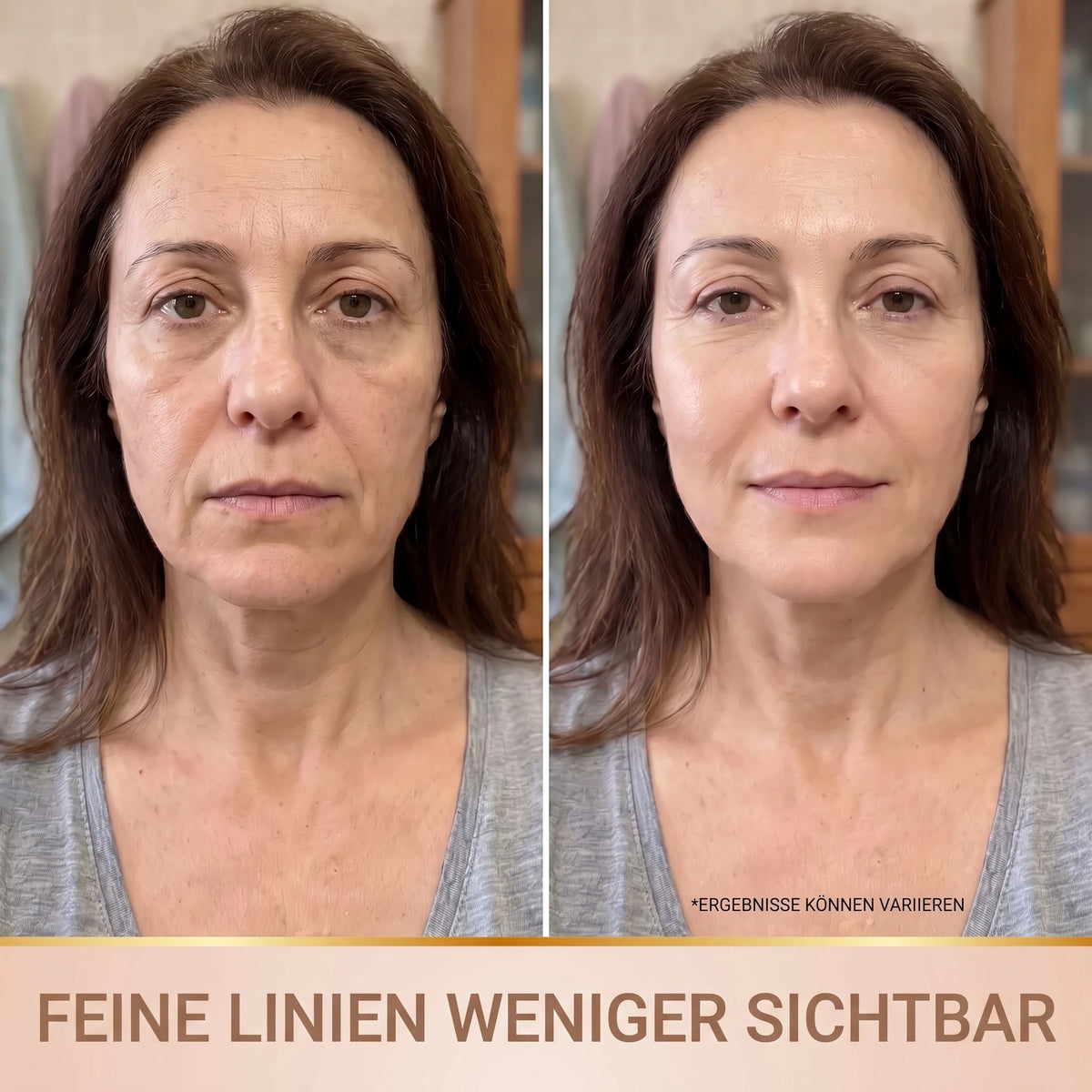 Vorher-Nachher: feine Linien weniger sichtbar