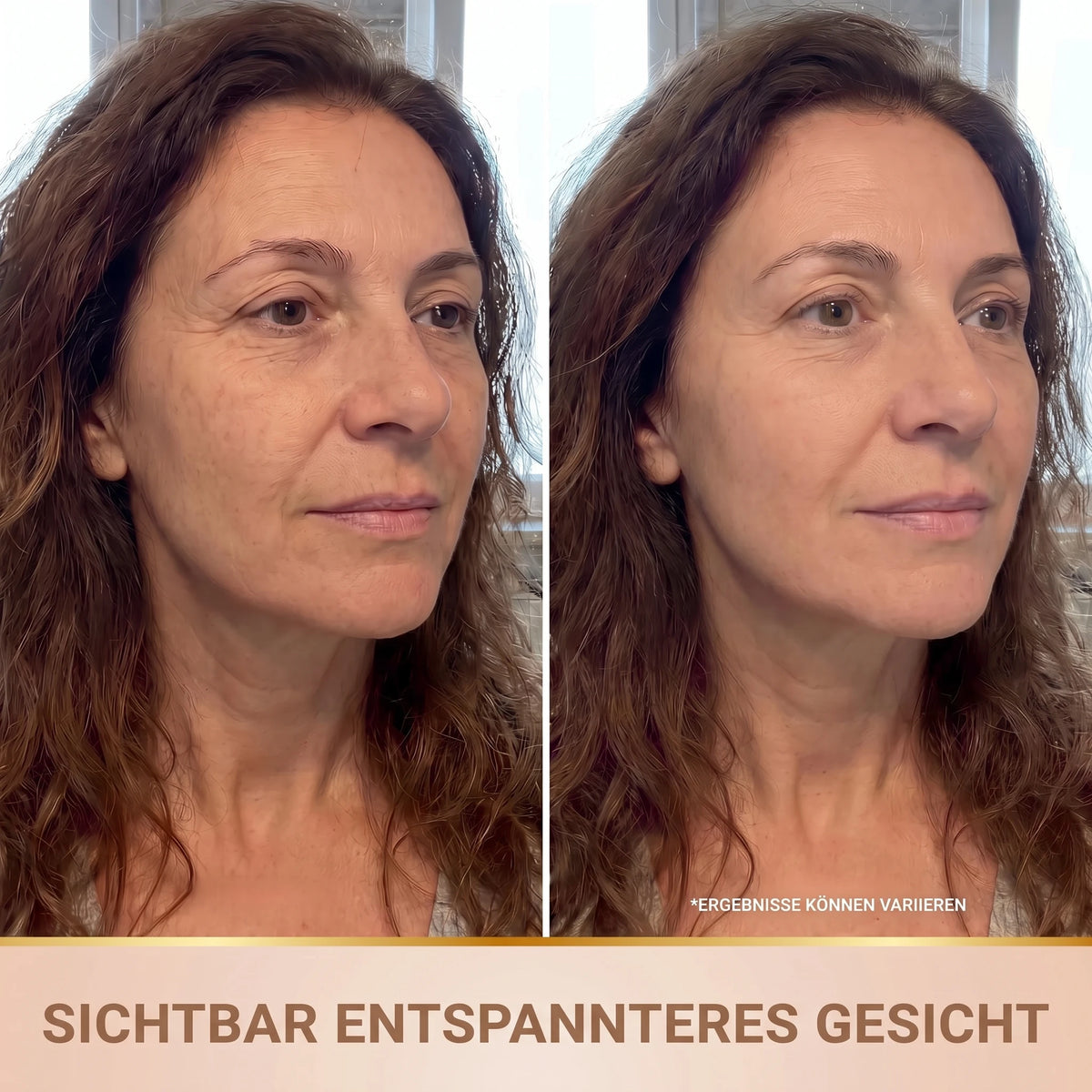 Vorher-Nachher: sichtbar entspannteres Gesicht