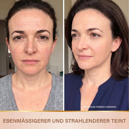 Vorher-Nachher: ebenmäßigerer und strahlenderer Teint